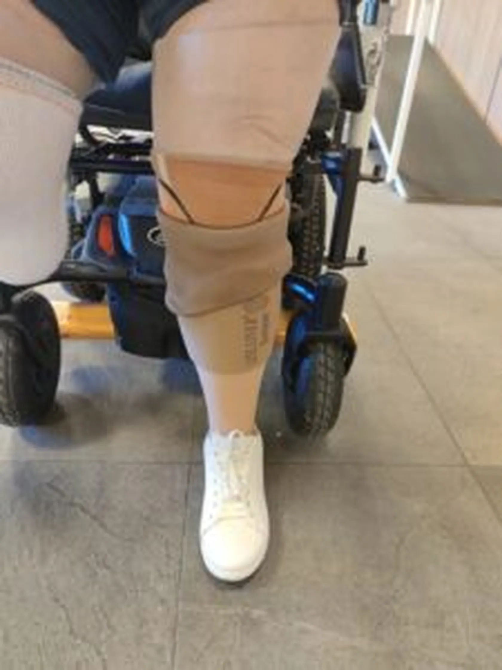 Fisioterapia-para-amputados-DOmusVi-Alcala-de-Guadaira-3-225x300.jpg