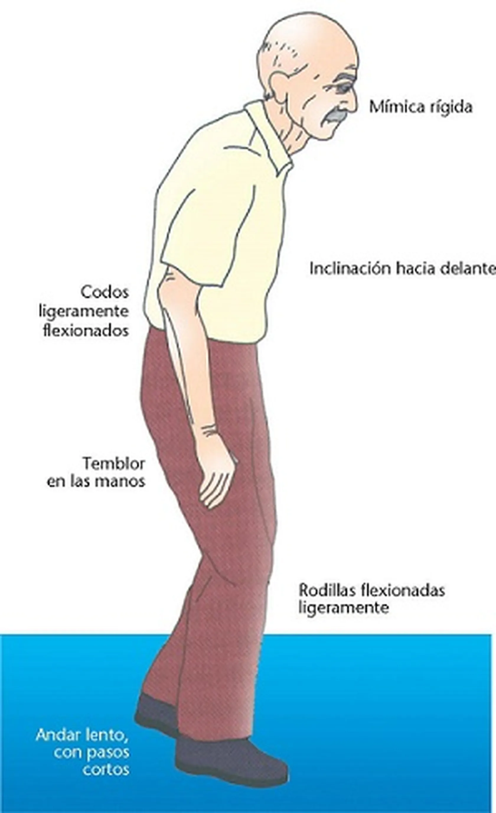 Fisioterapia-en-la-enfermedad-de-parkinson-DomusVi-Alcalá-de-Guadaíra.jpg