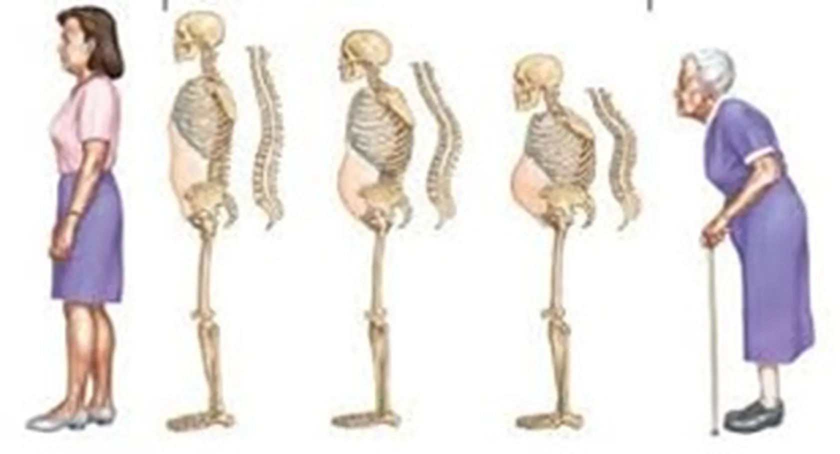 Función-endocrina-de-los-huesos-en-DomusVi-Alcalá-de-Guadaíra.jpg