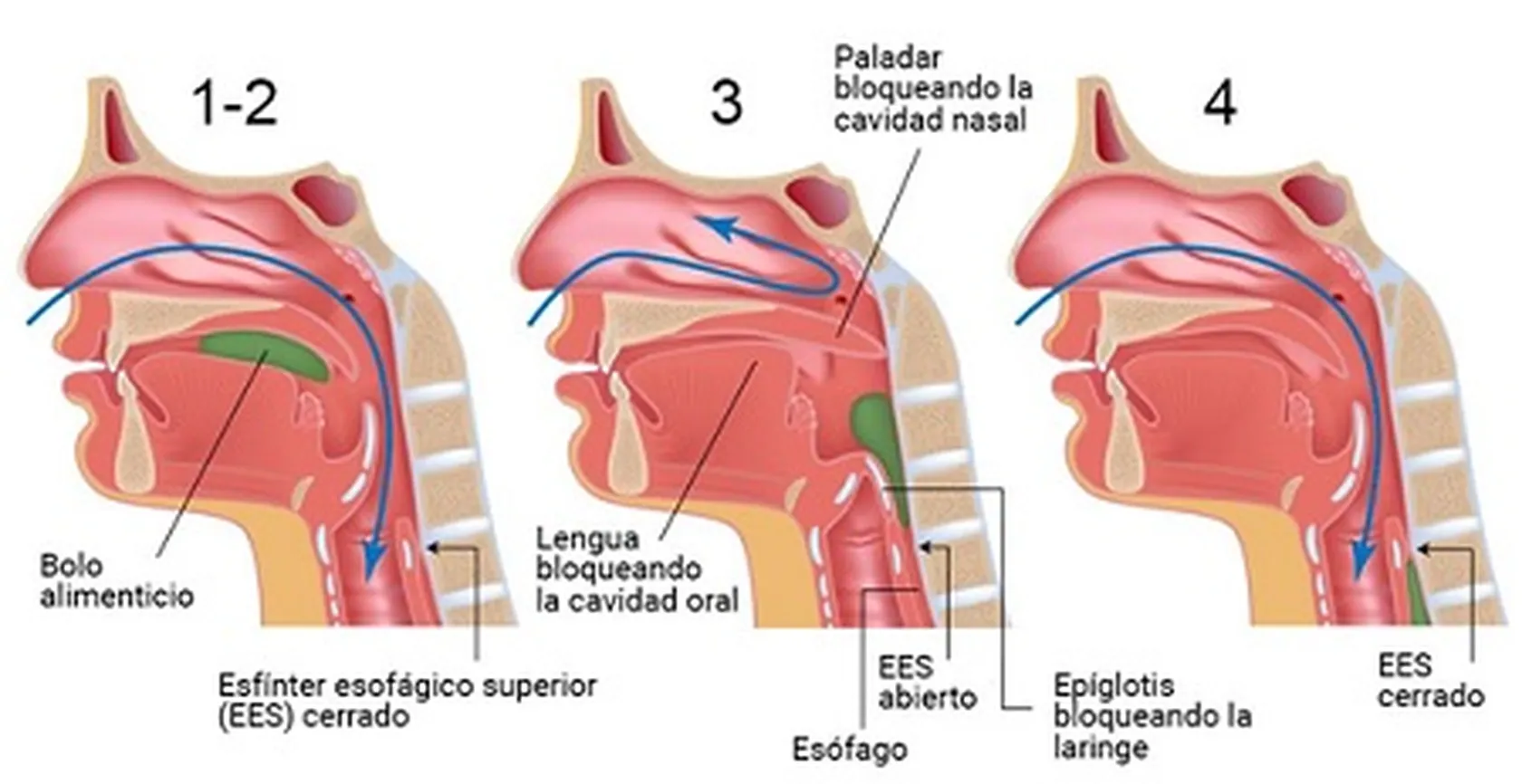 La-fisioterapia-en-la-disfagia-DomusVi-Alcala-de-Guadaira.jpg