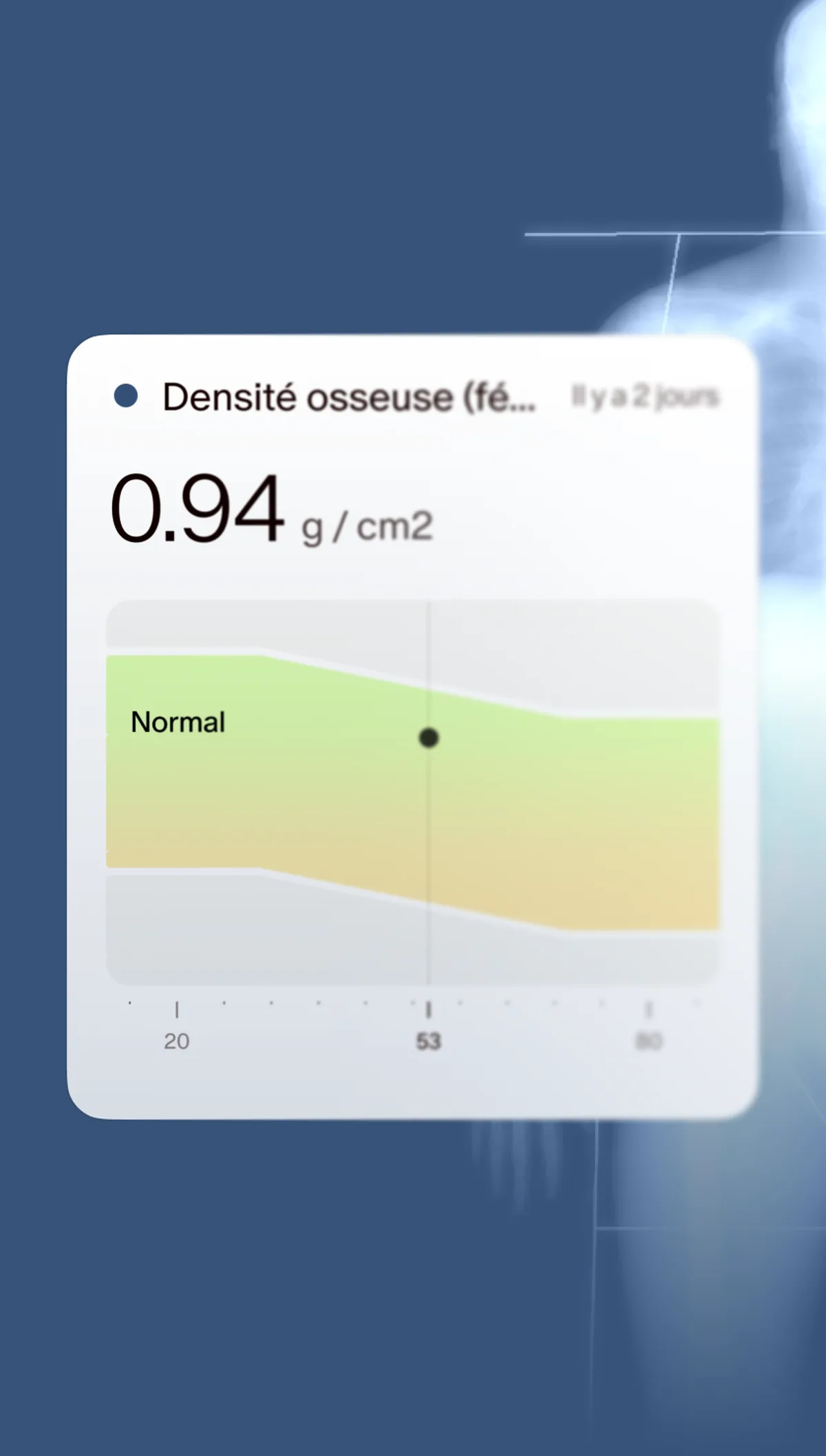 Scan DEXA
