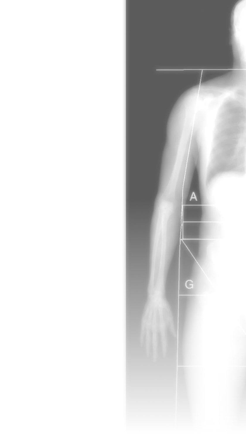 DEXA scan
