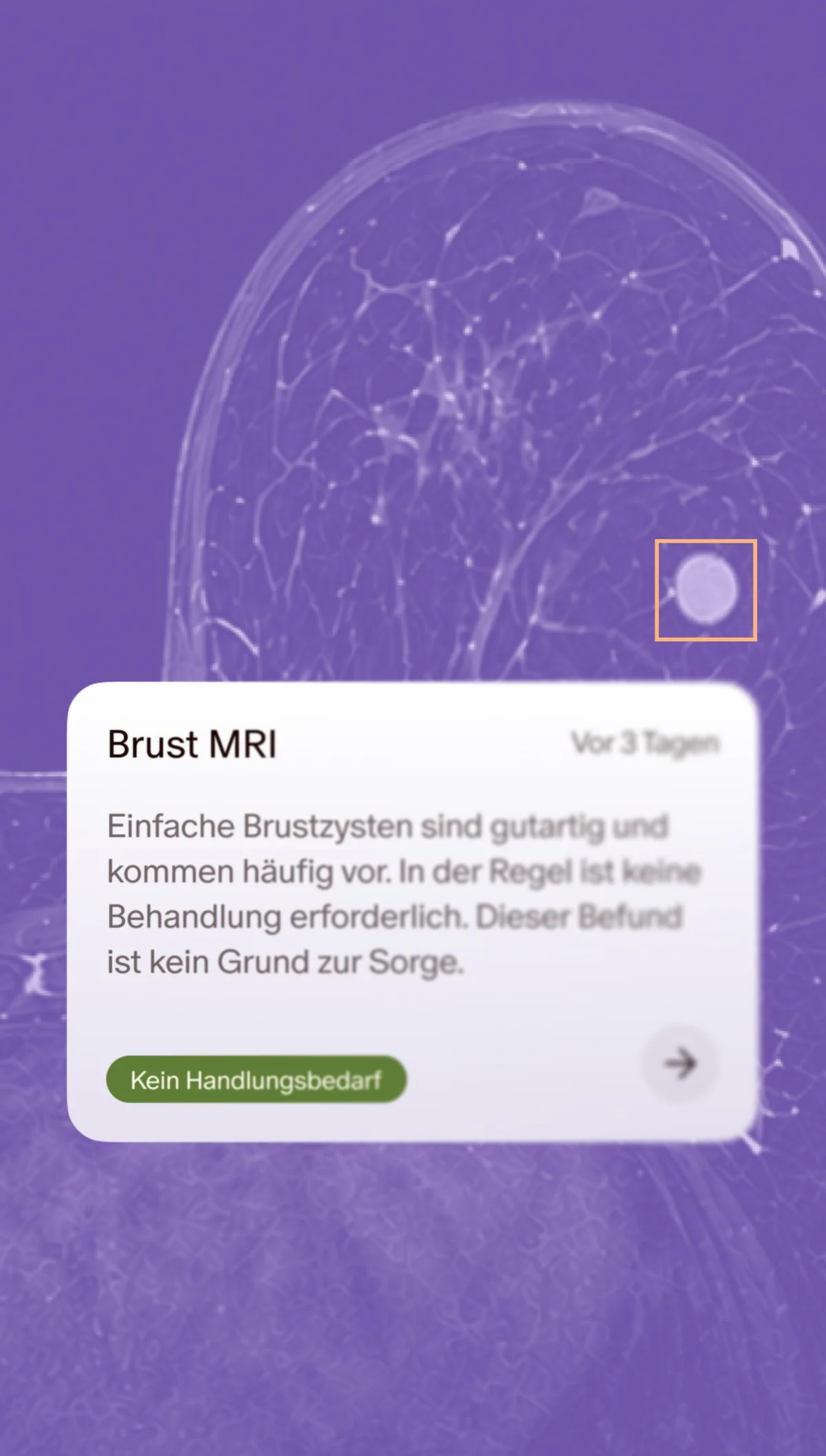 Brust-Check-up