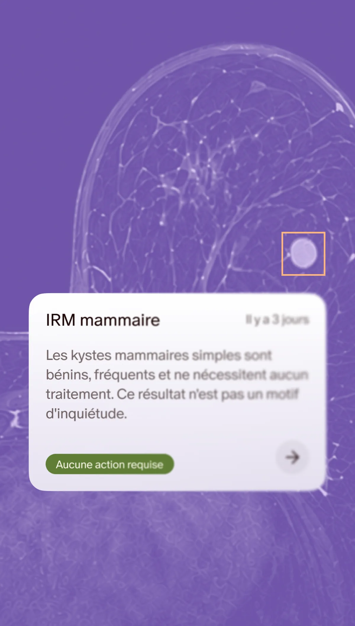 Bilan mammaire