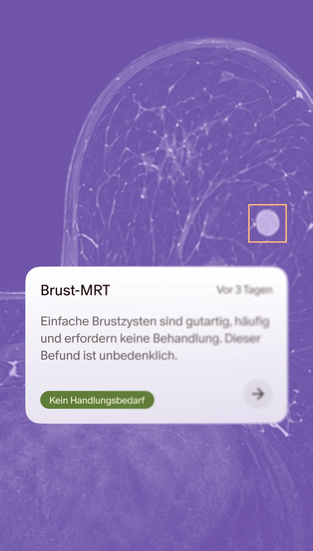 Brust-Check-up