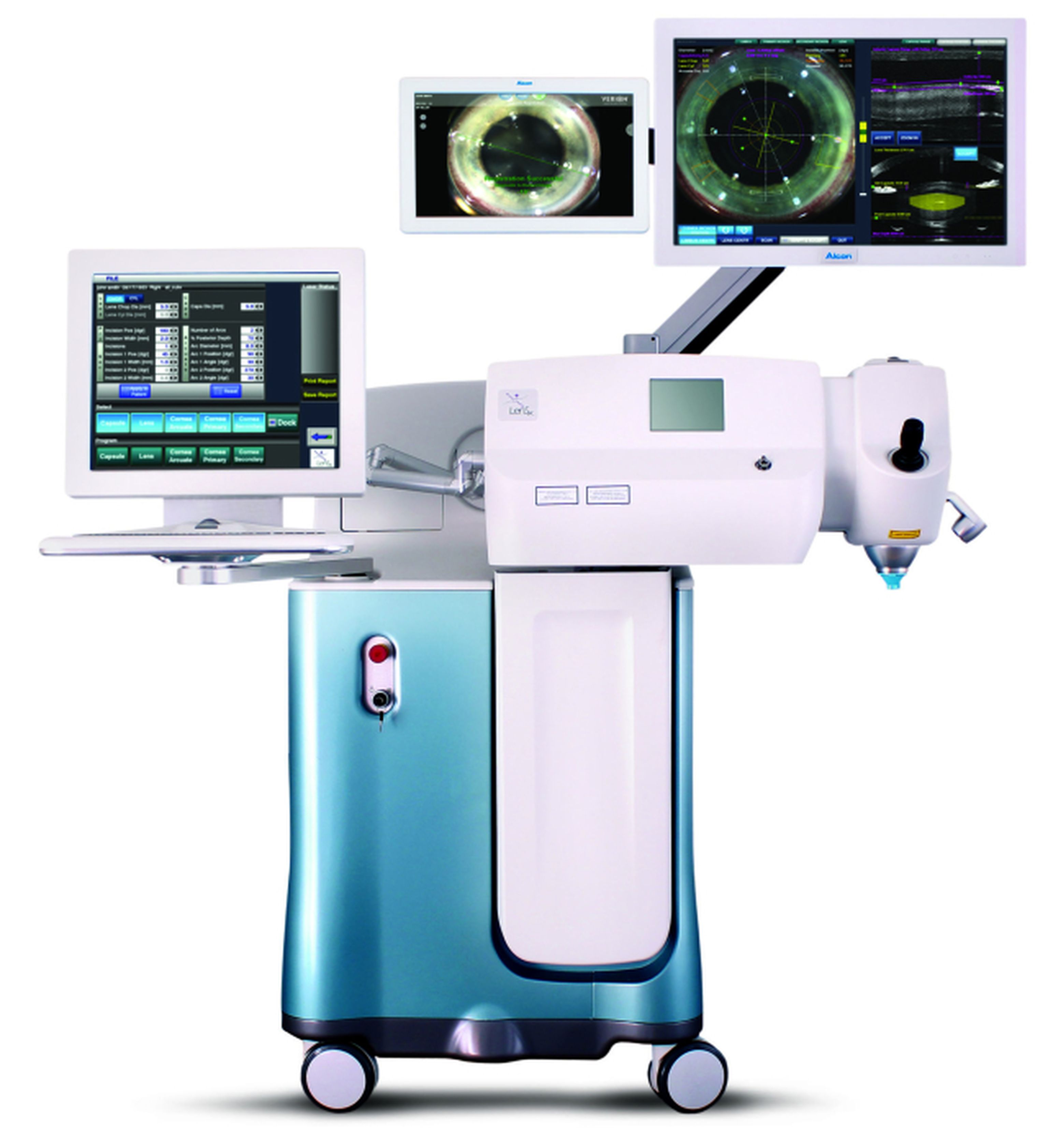 Il Computer Opera la Cataratta