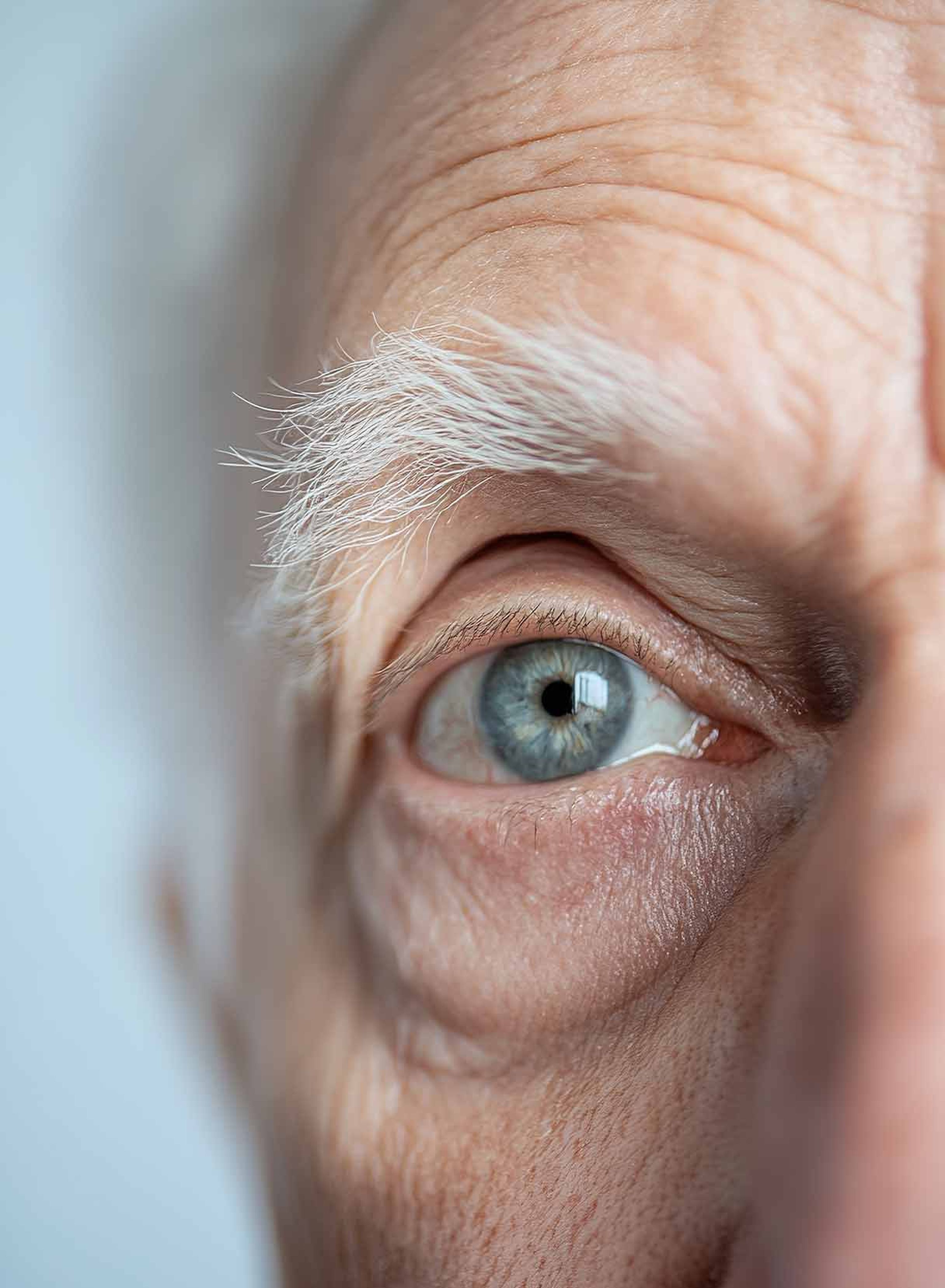 occhio di persona in età avanzata dopo intervento di cataratta