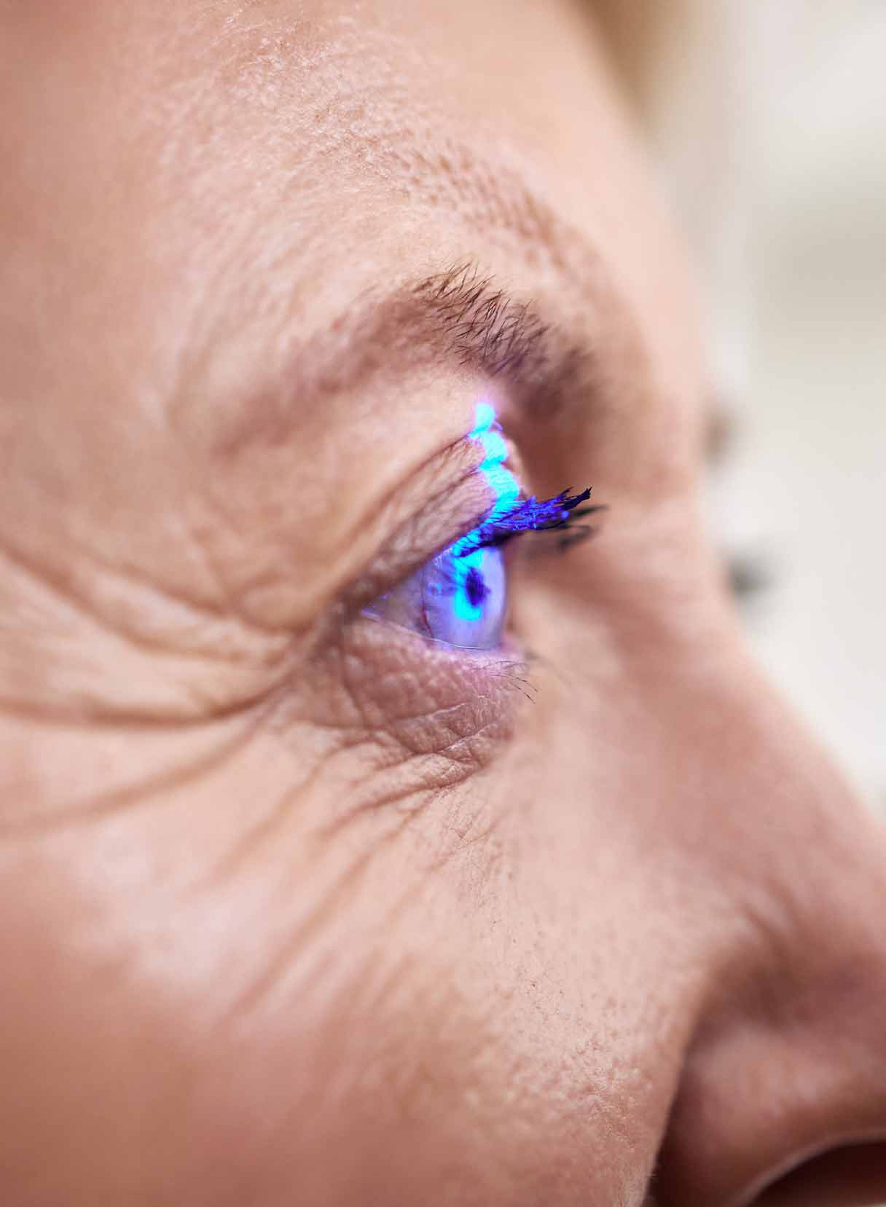 Intervento laser occhi per più difetti visivi