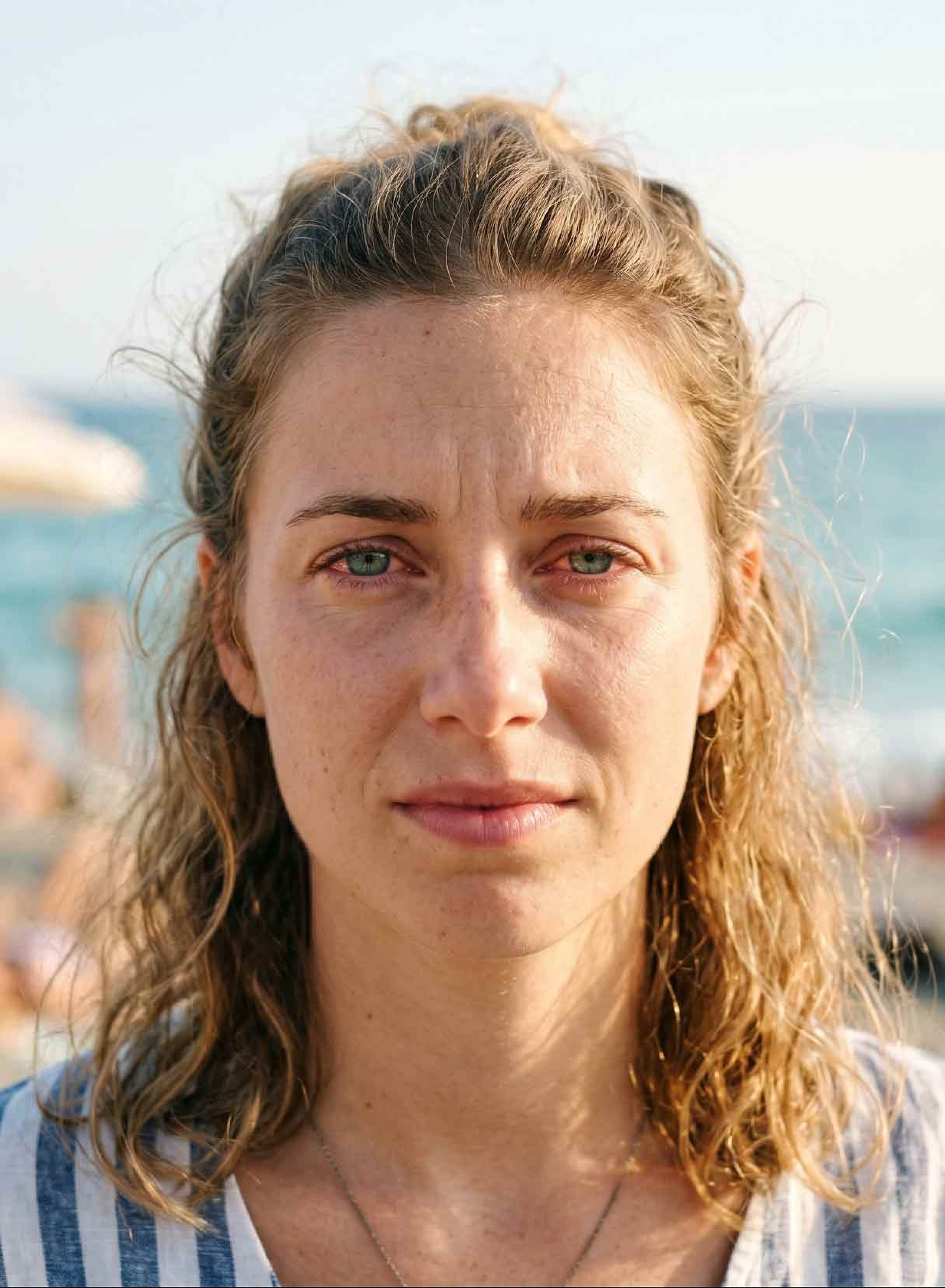 ragazza soffre di occhio secco in estate