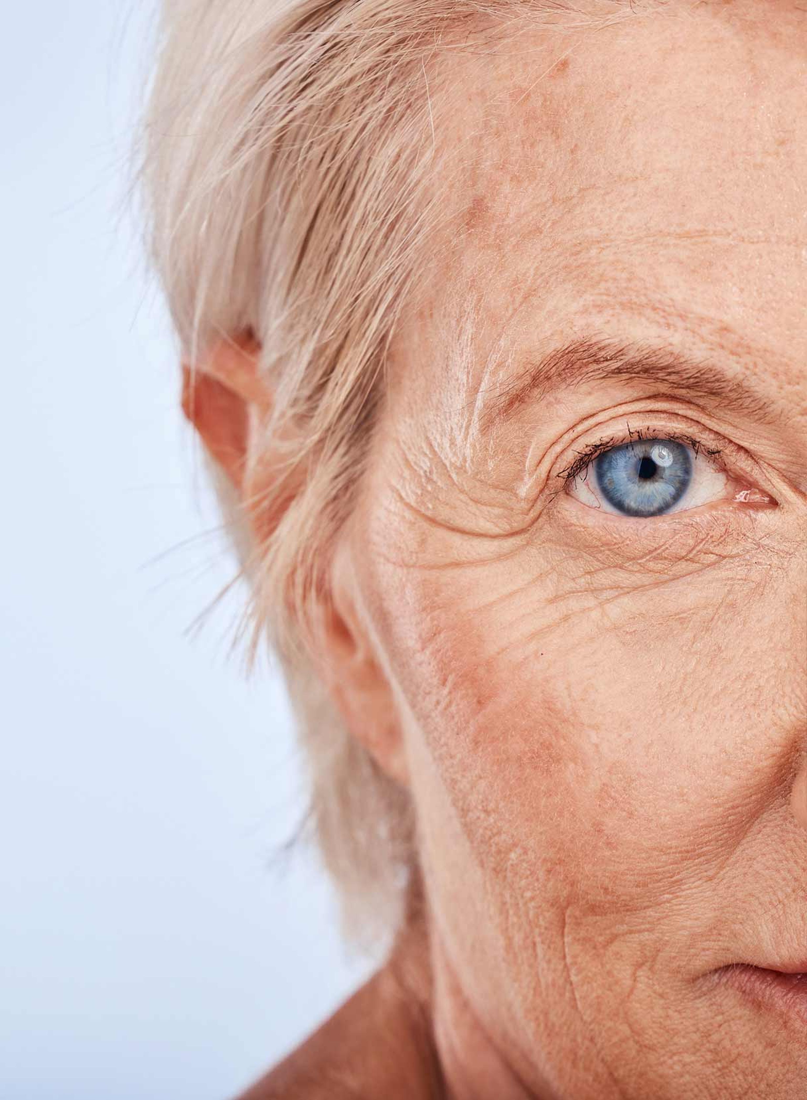 primo piano di donna anziana prima di sottoporsi a intervento di cataratta