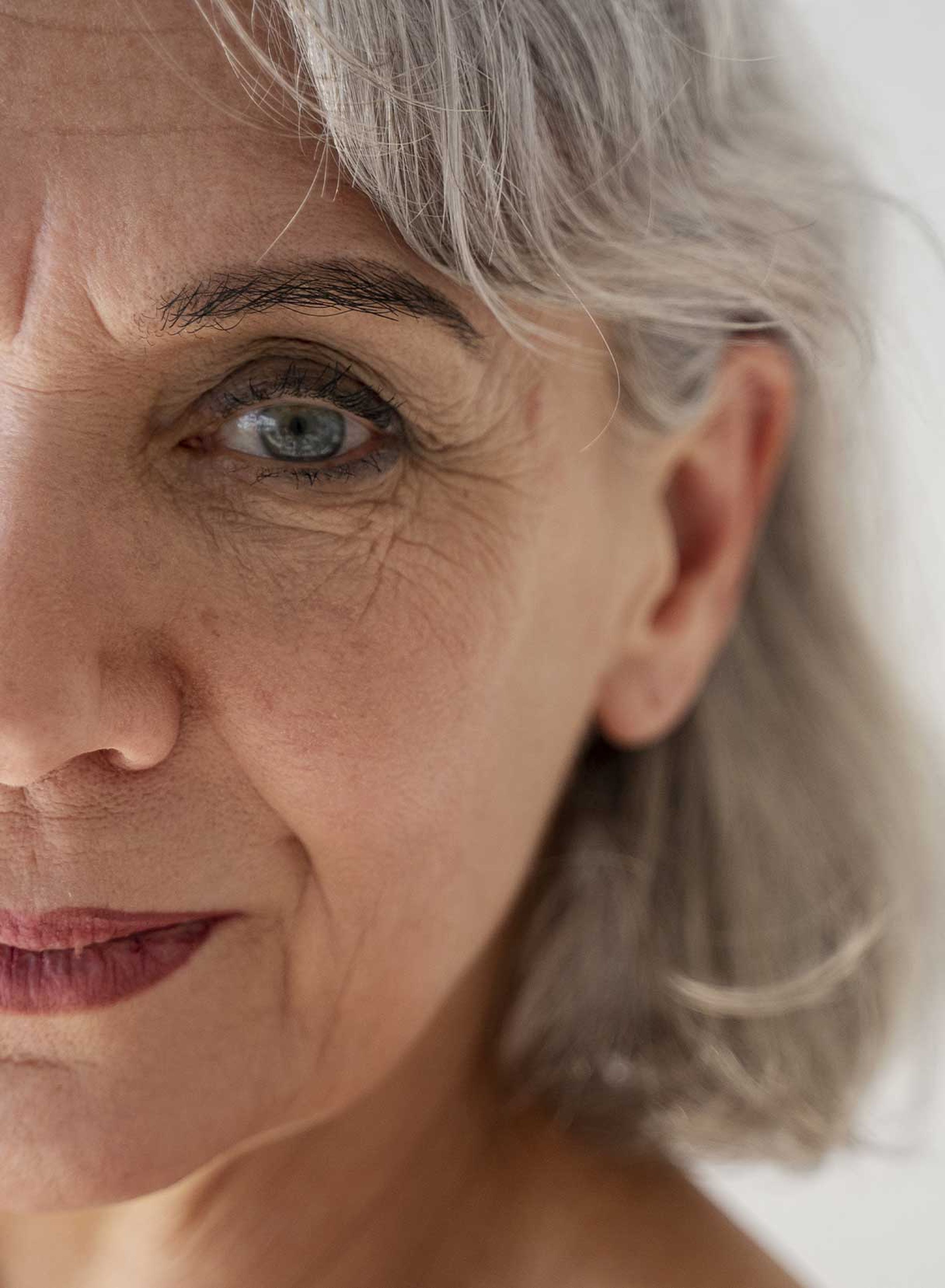 donna post intervento di cataratta