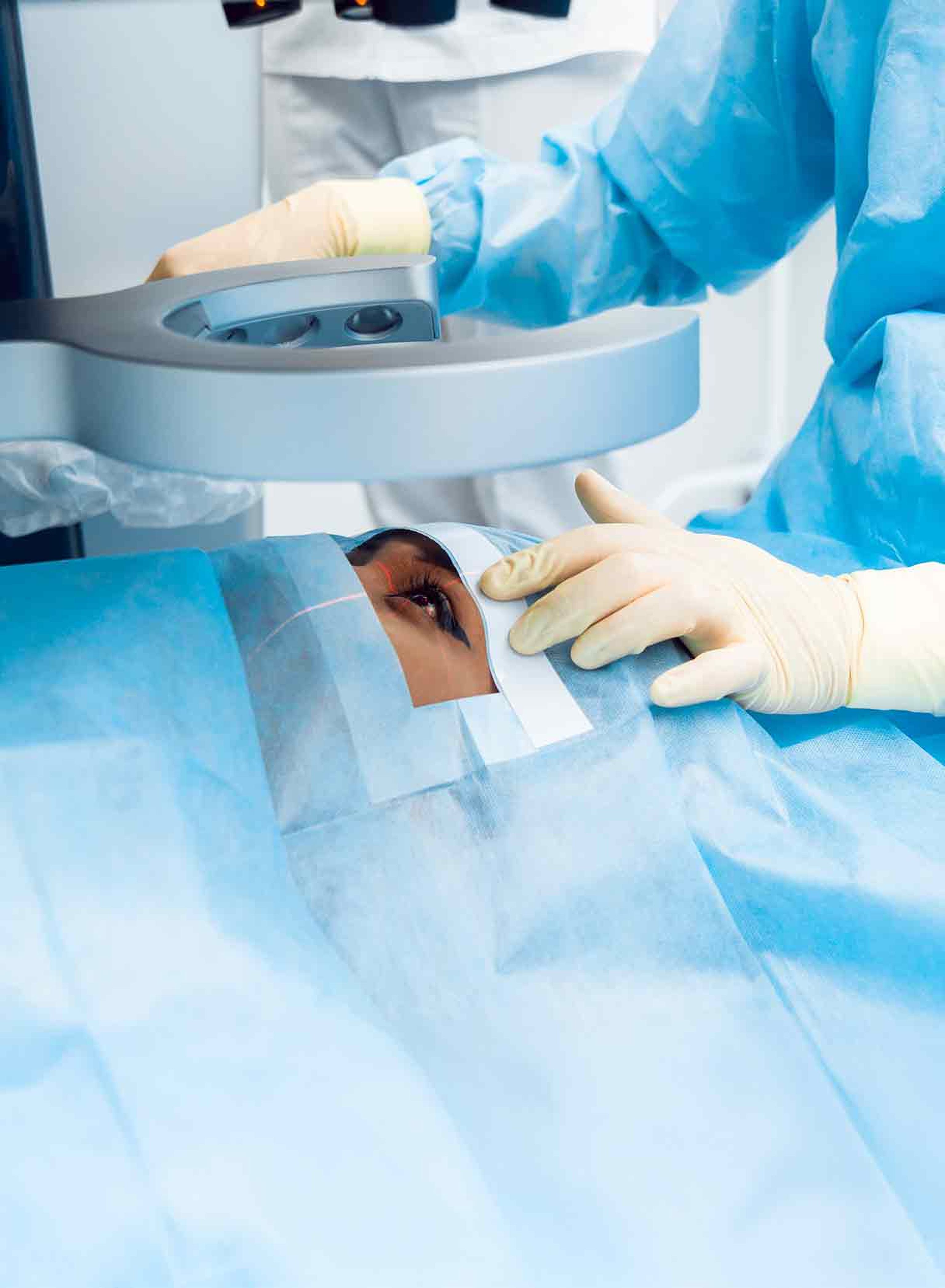 Impianto di lenti ICL in corso per correggere la vista