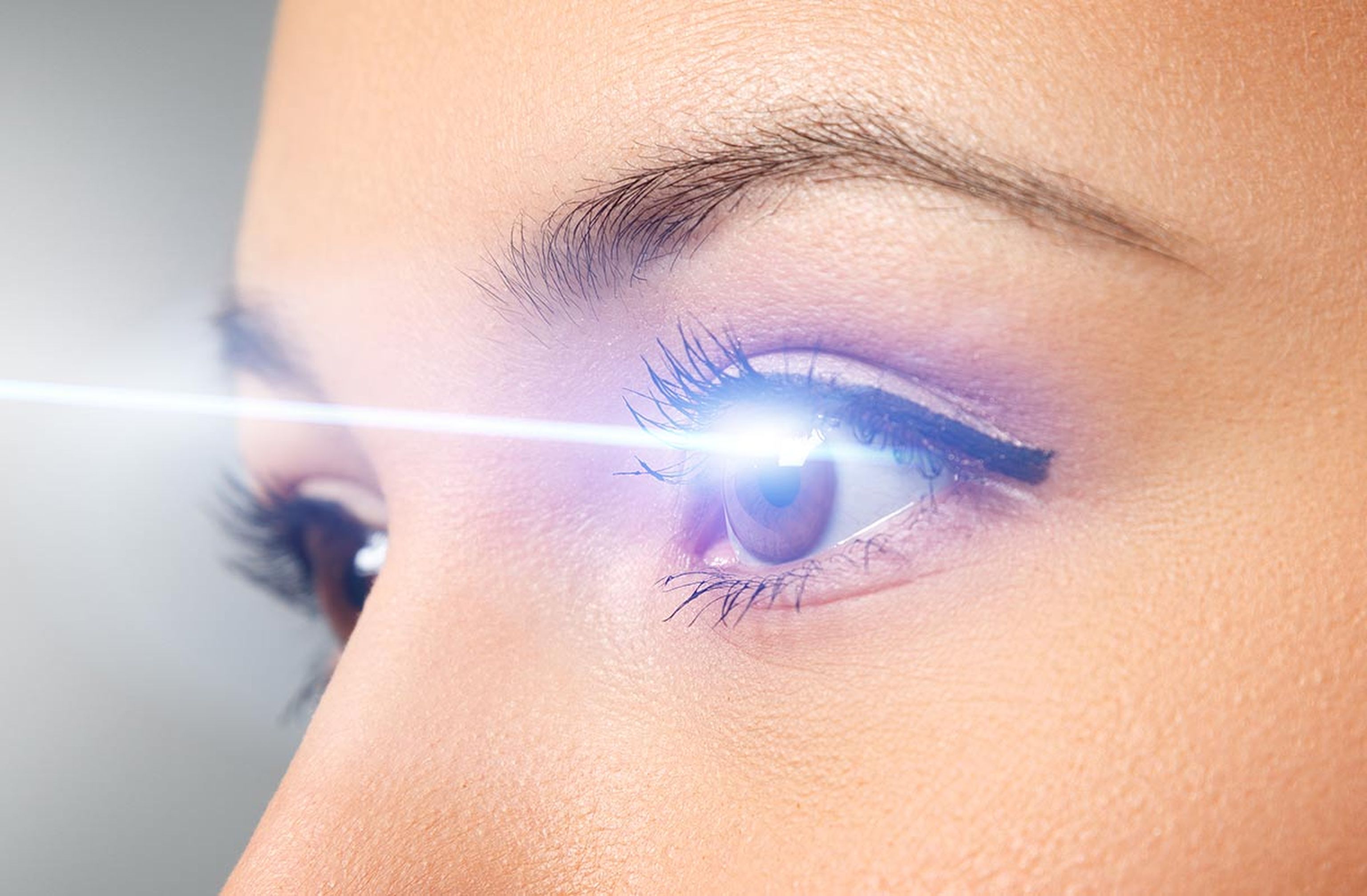 differenze tra PRK e Femto-LASIK