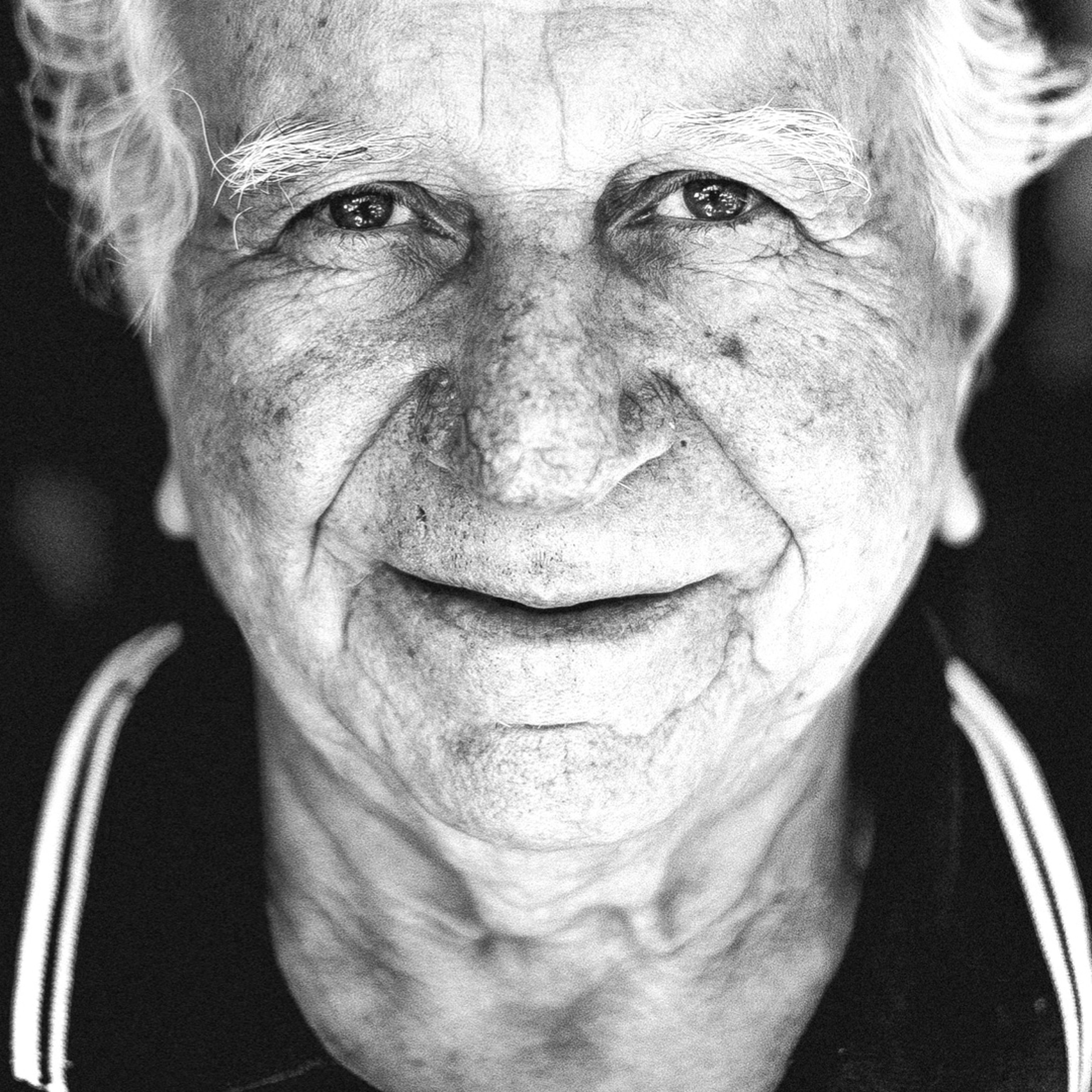 Cataratta: come curarla