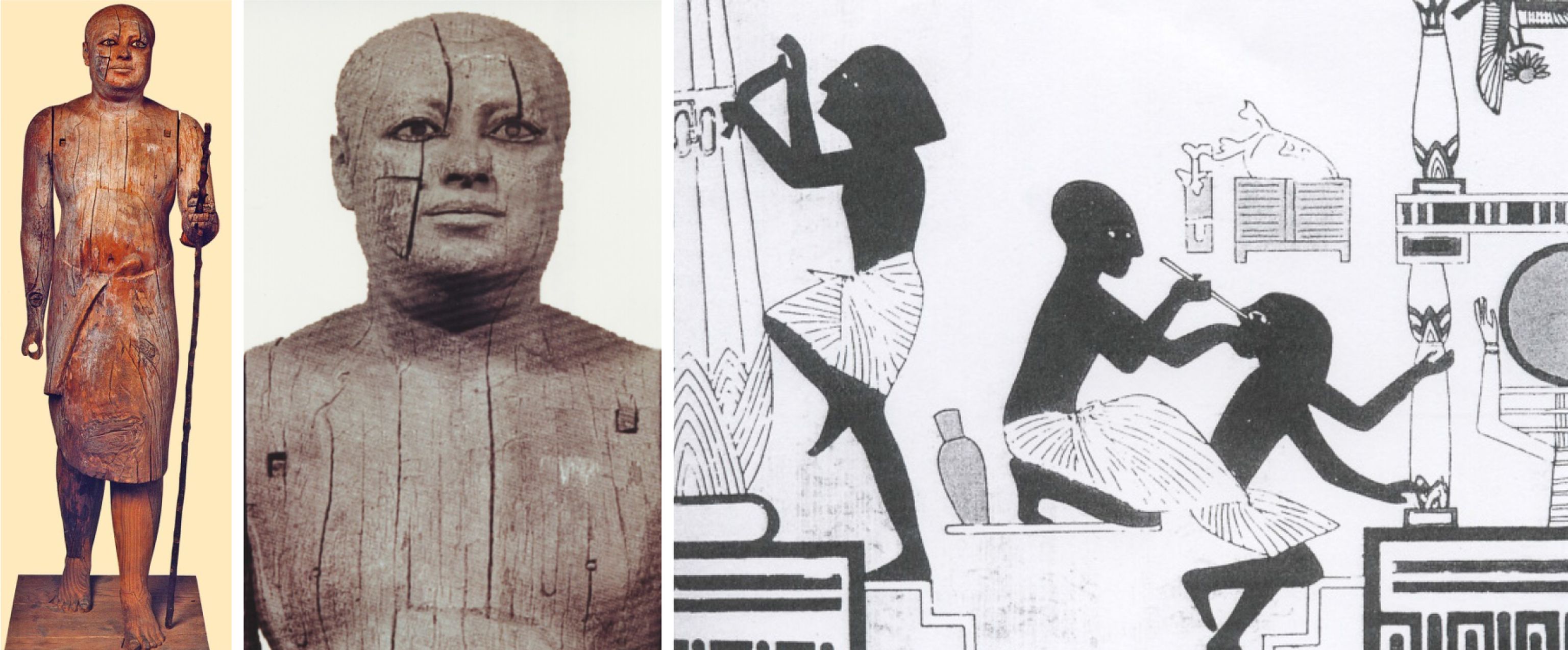 La Cataratta - storia ed evoluzione