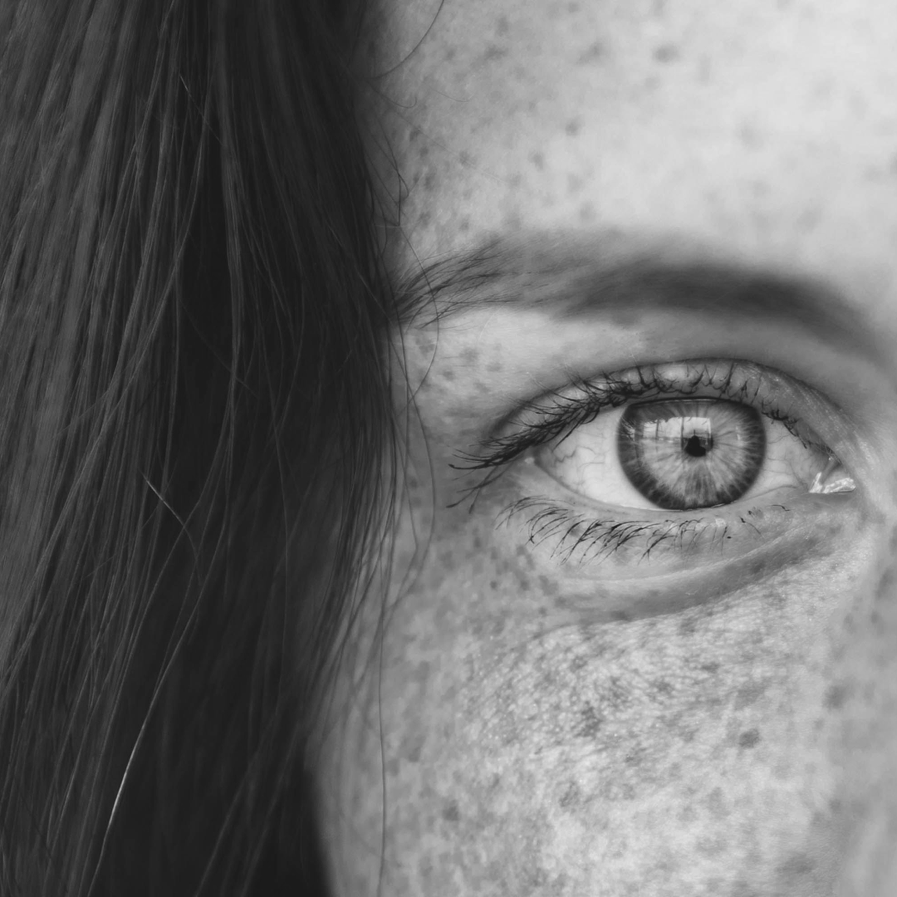 Cosa fare in caso di calazio