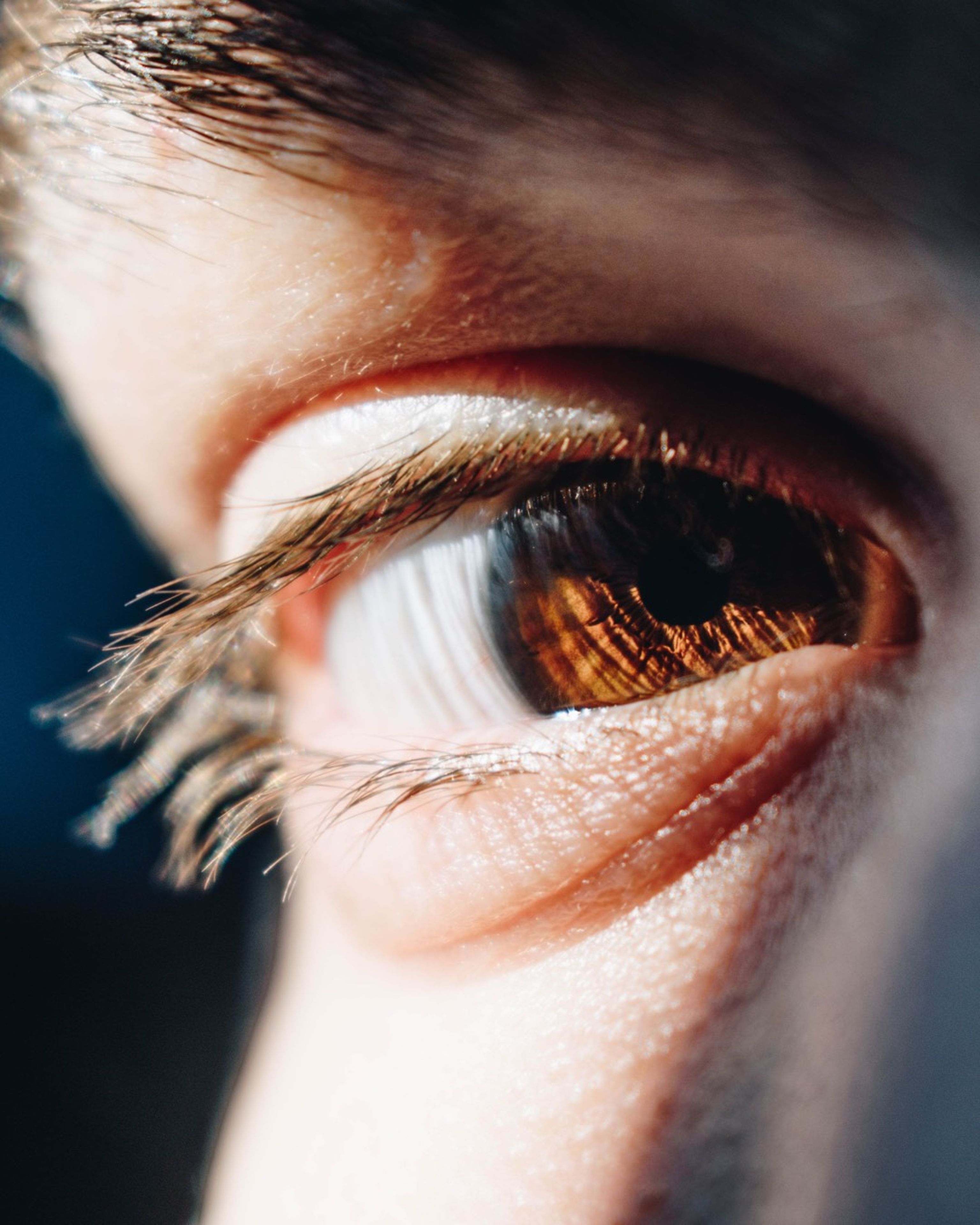 NISTAGMO: il movimento involontario degli occhi