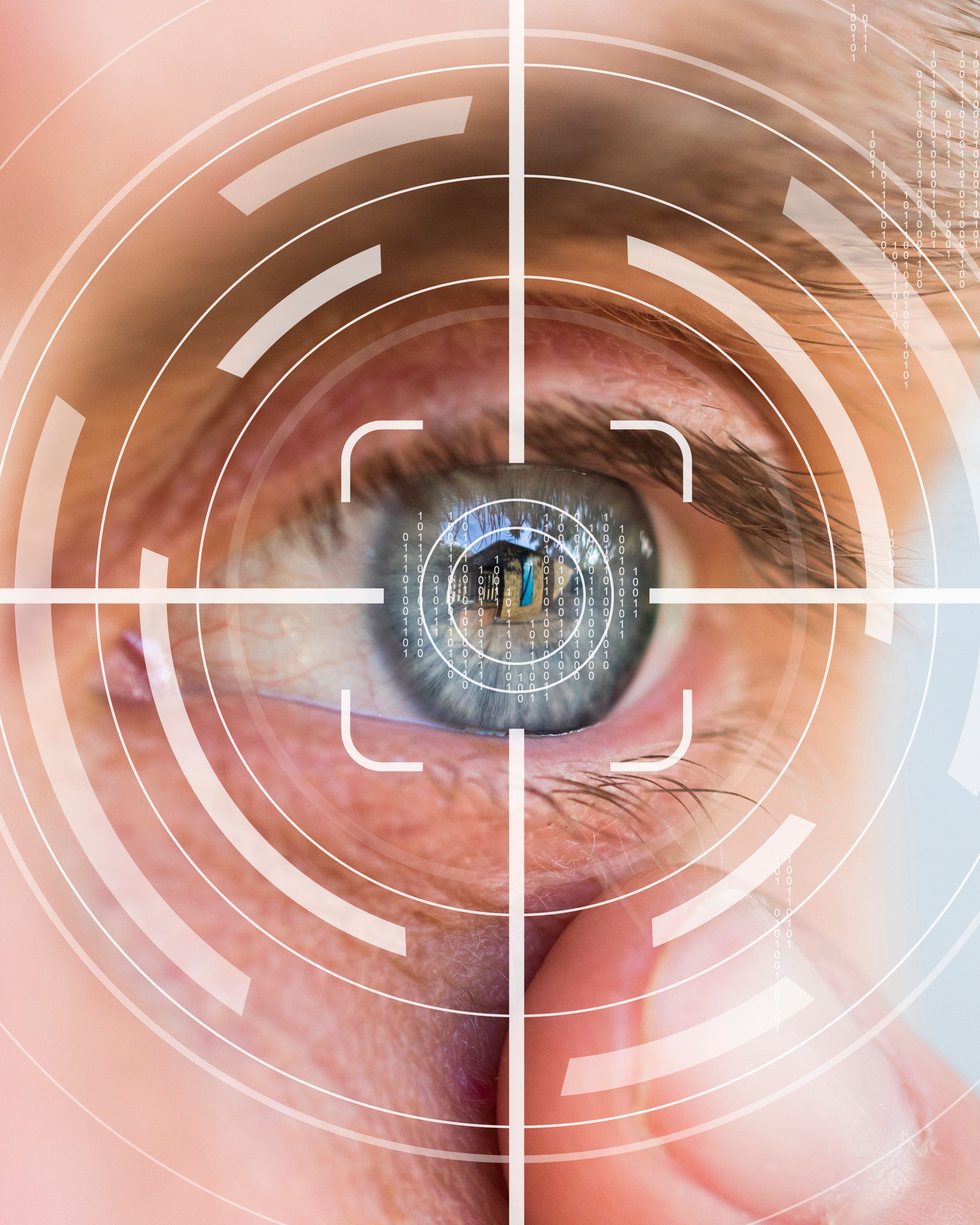 Mix di tecniche di chirurgia refrattiva