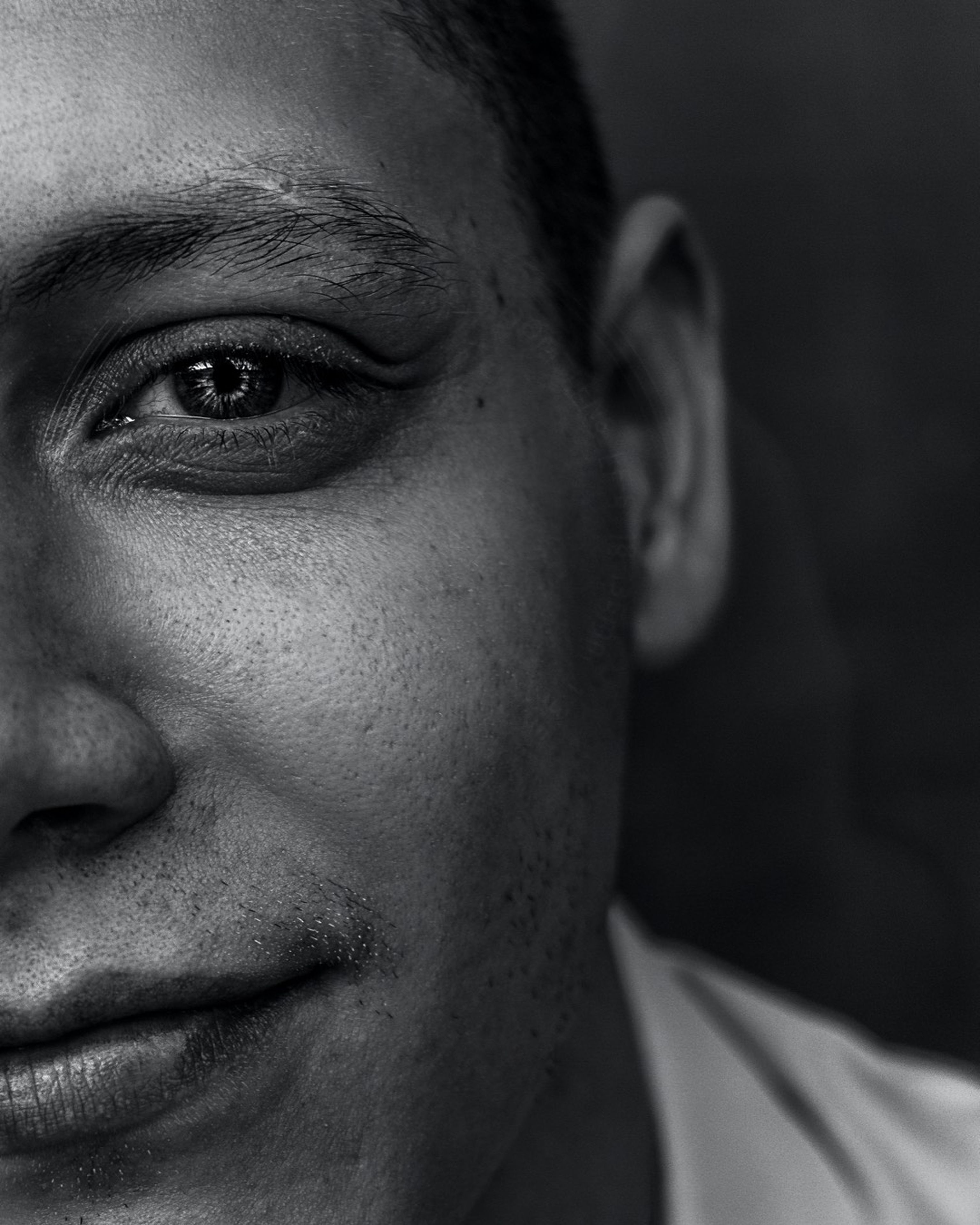 GLAUCOMA: il ladro silenzioso della vista 