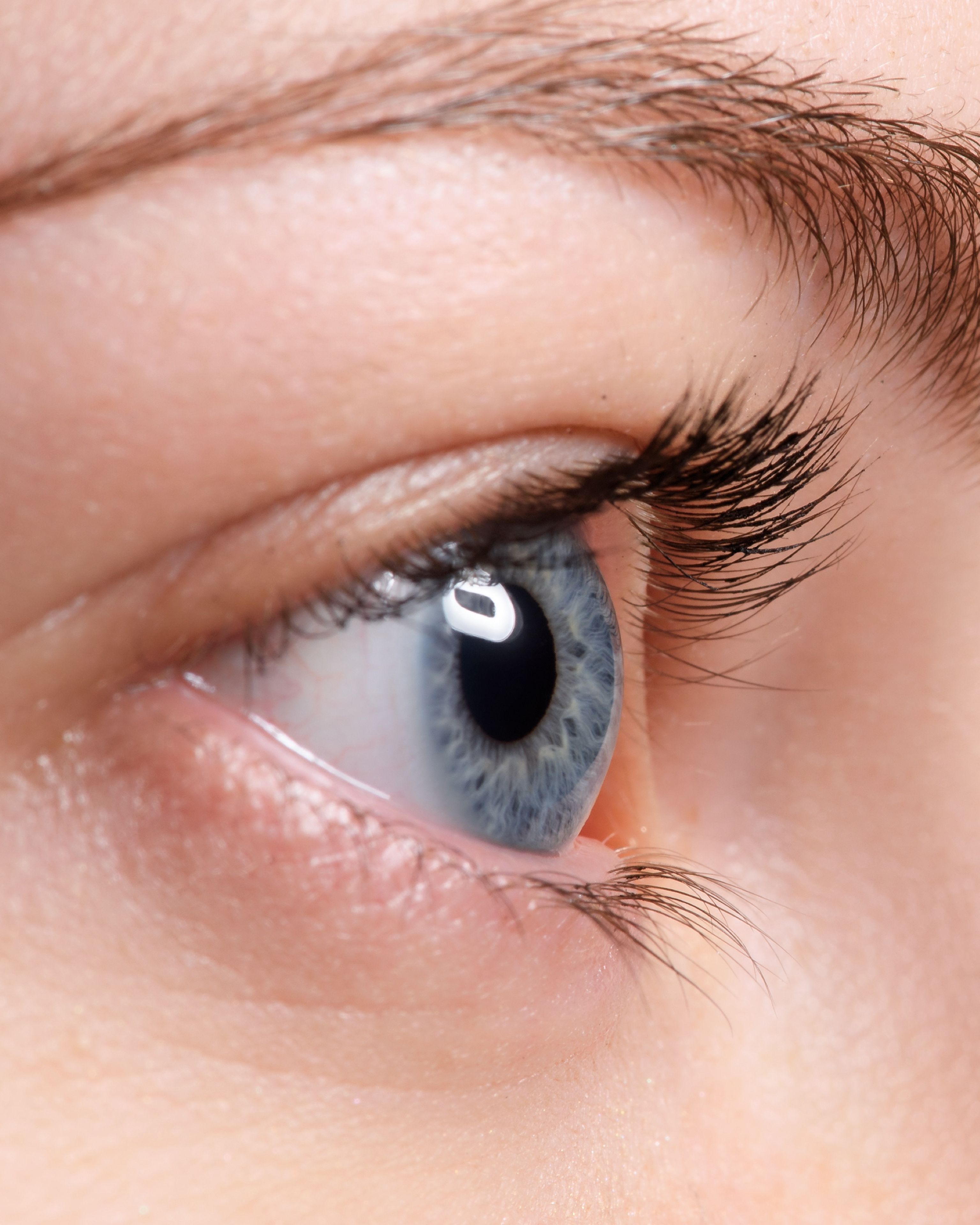 Corioretinopatia sierosa centrale