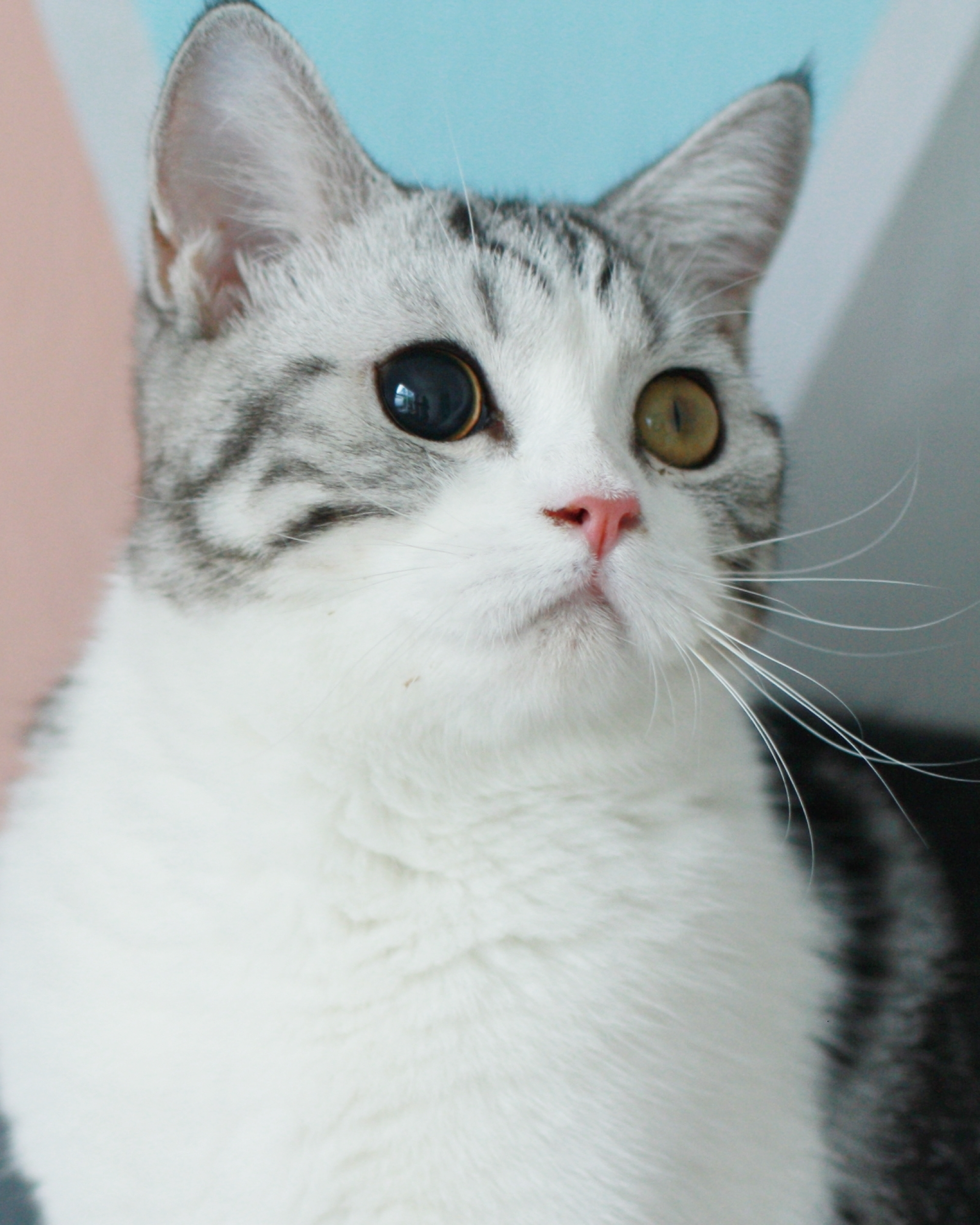 Anisocoria: di cosa si tratta