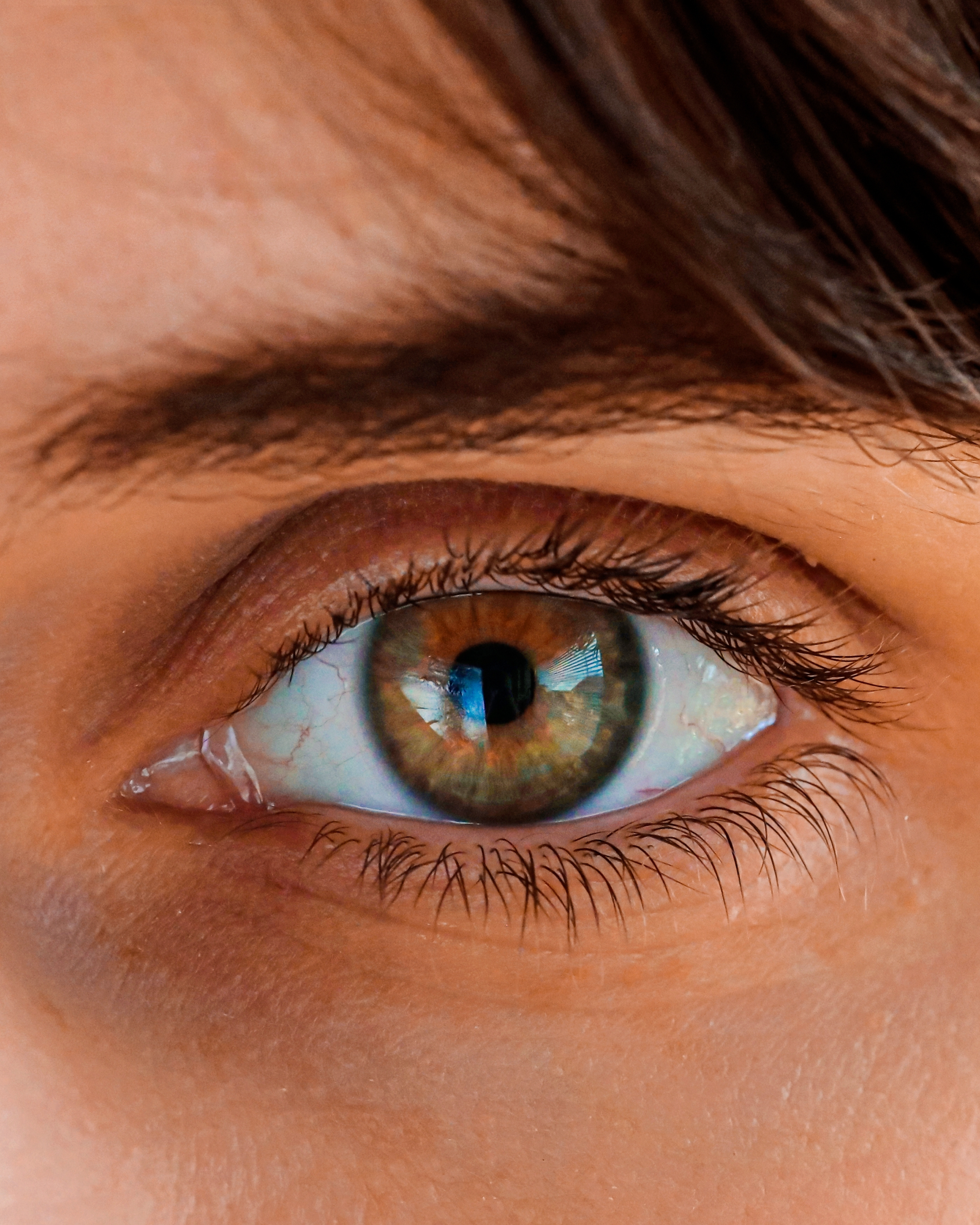 Posso correggere l’astigmatismo con la chirurgia refrattiva?