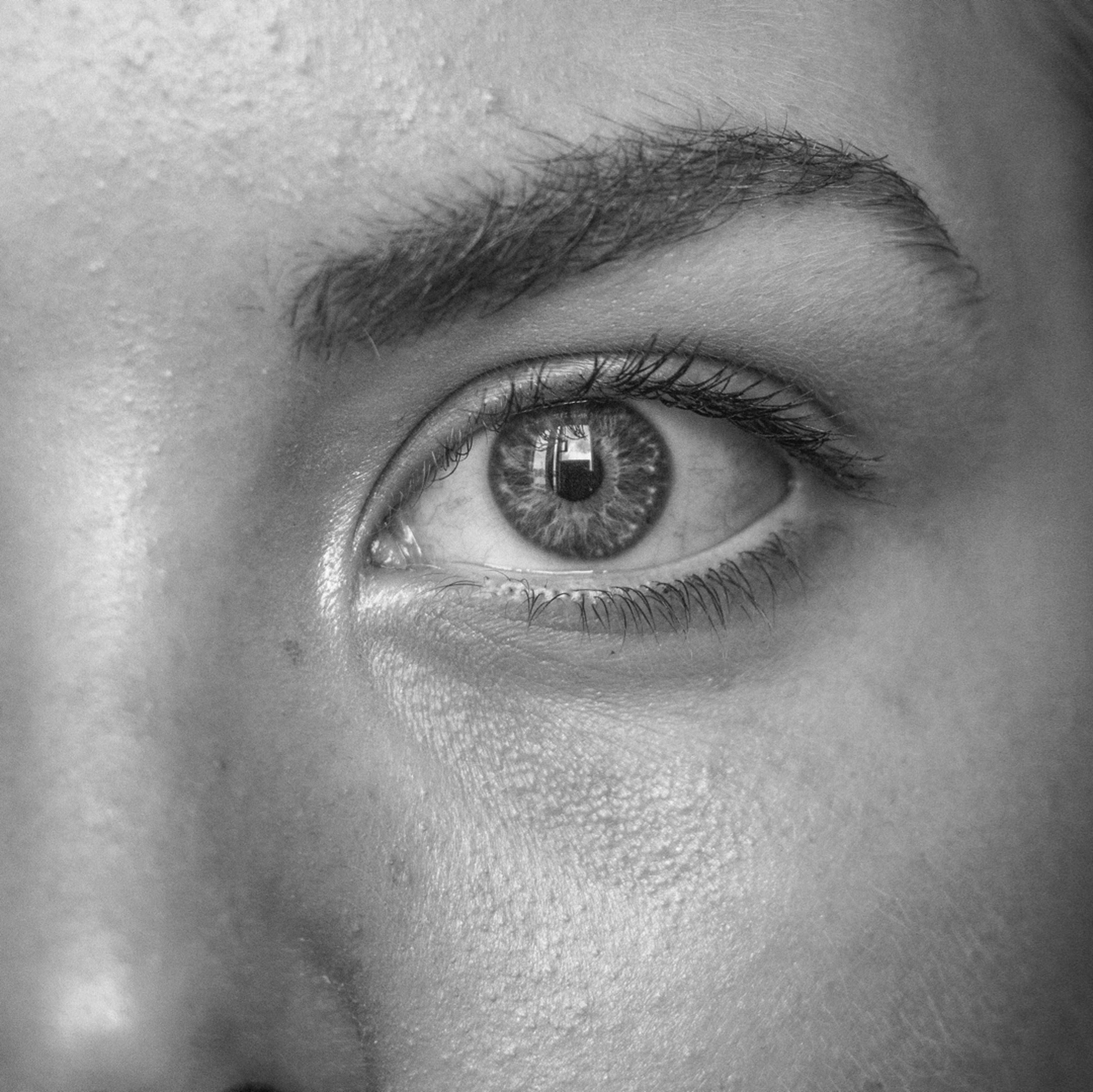 Glaucoma: sfatiamo qualche mito