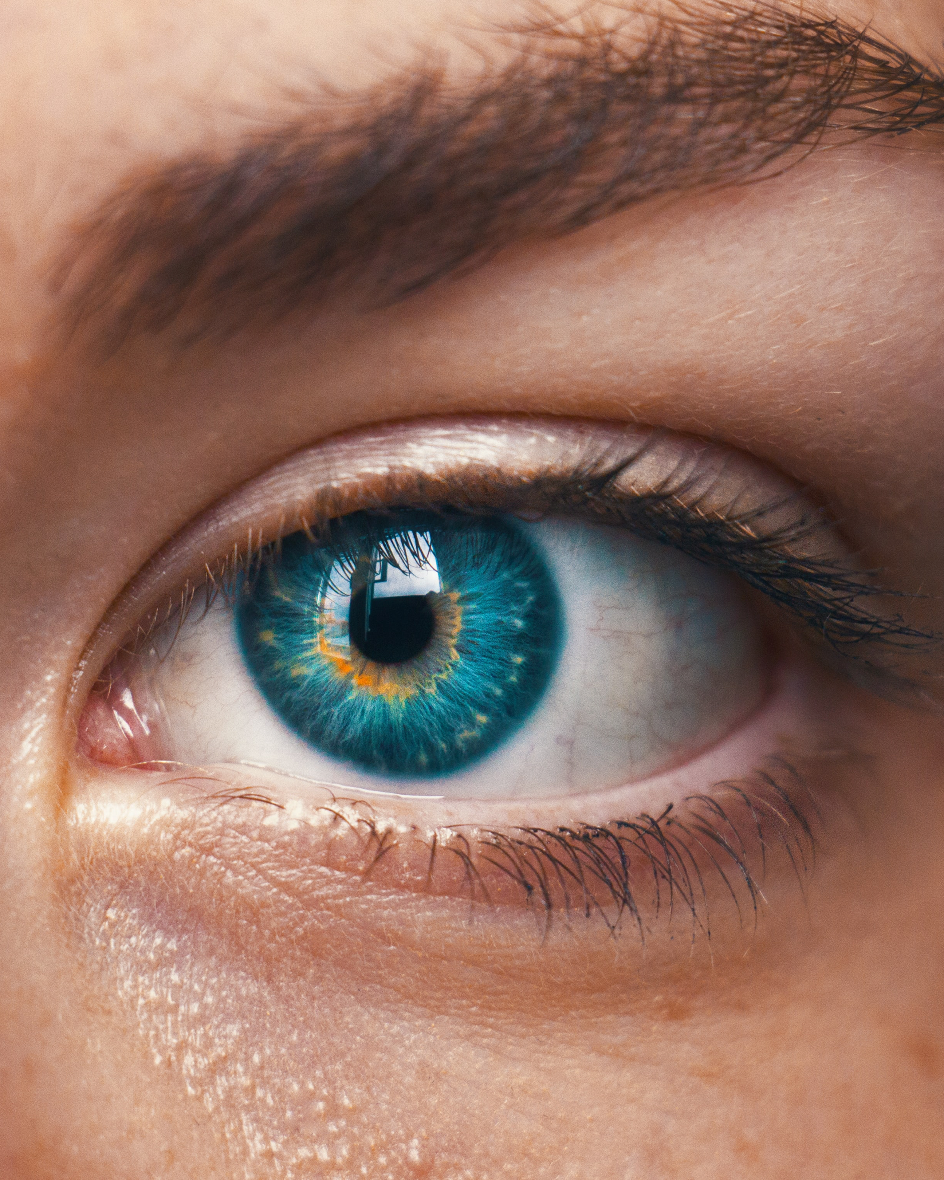 Perché vengono le occhiaie?