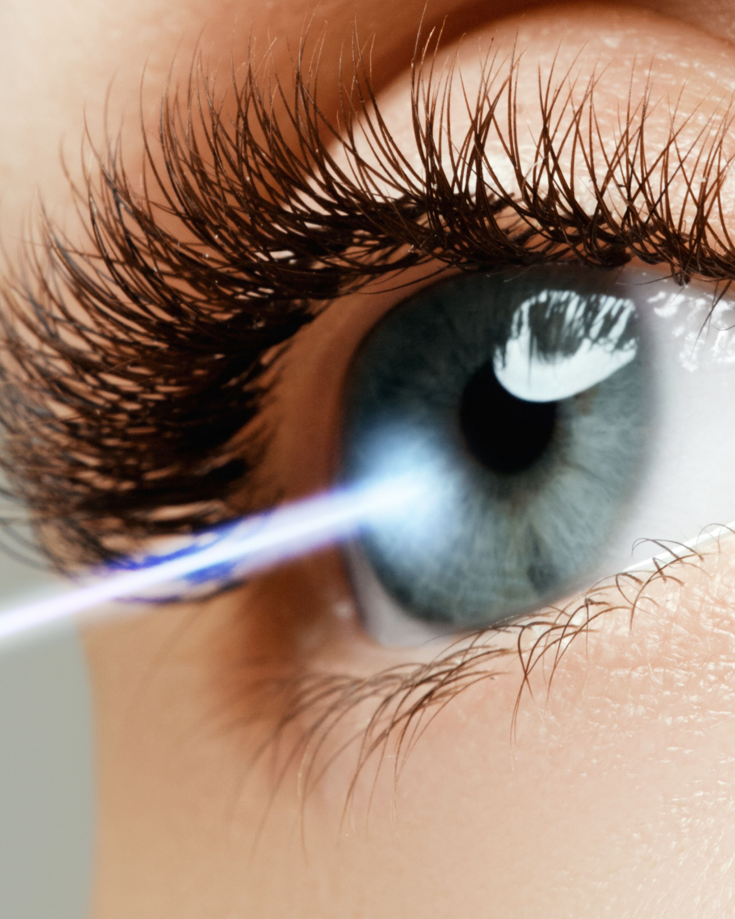 Le tre domande più frequenti sulla chirurgia refrattiva