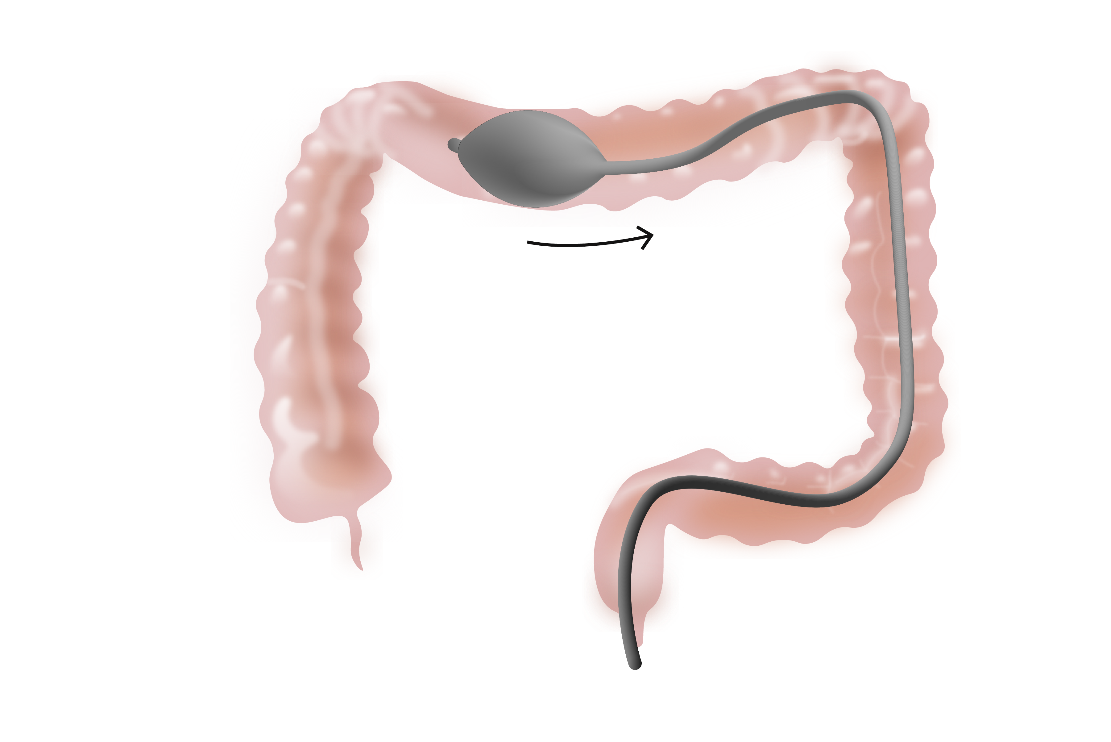 PENTAX Medical i10-Series HD+ video endoscopes