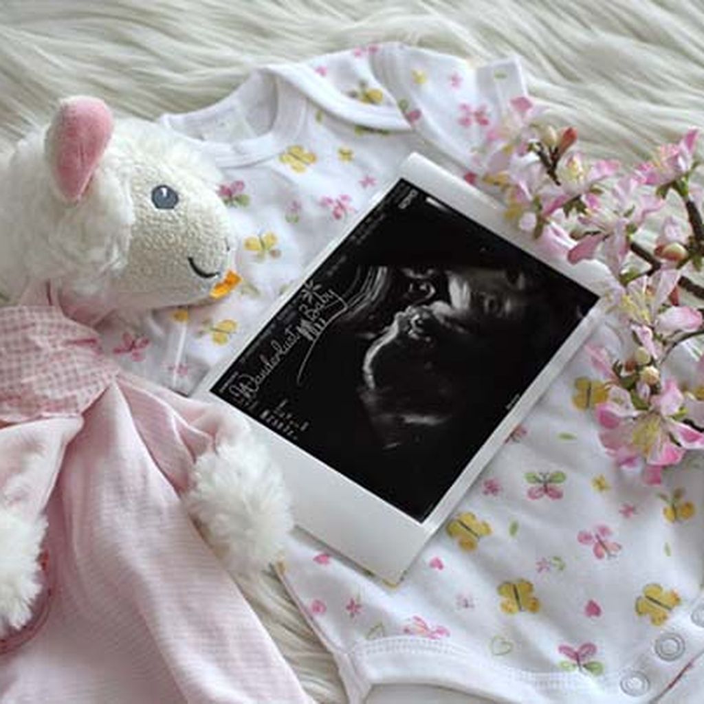 Ultraschallfoto. Daneben ein Kuscheltier und ein Babybody