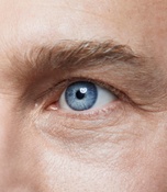 Can I have my eyes lasered image - left