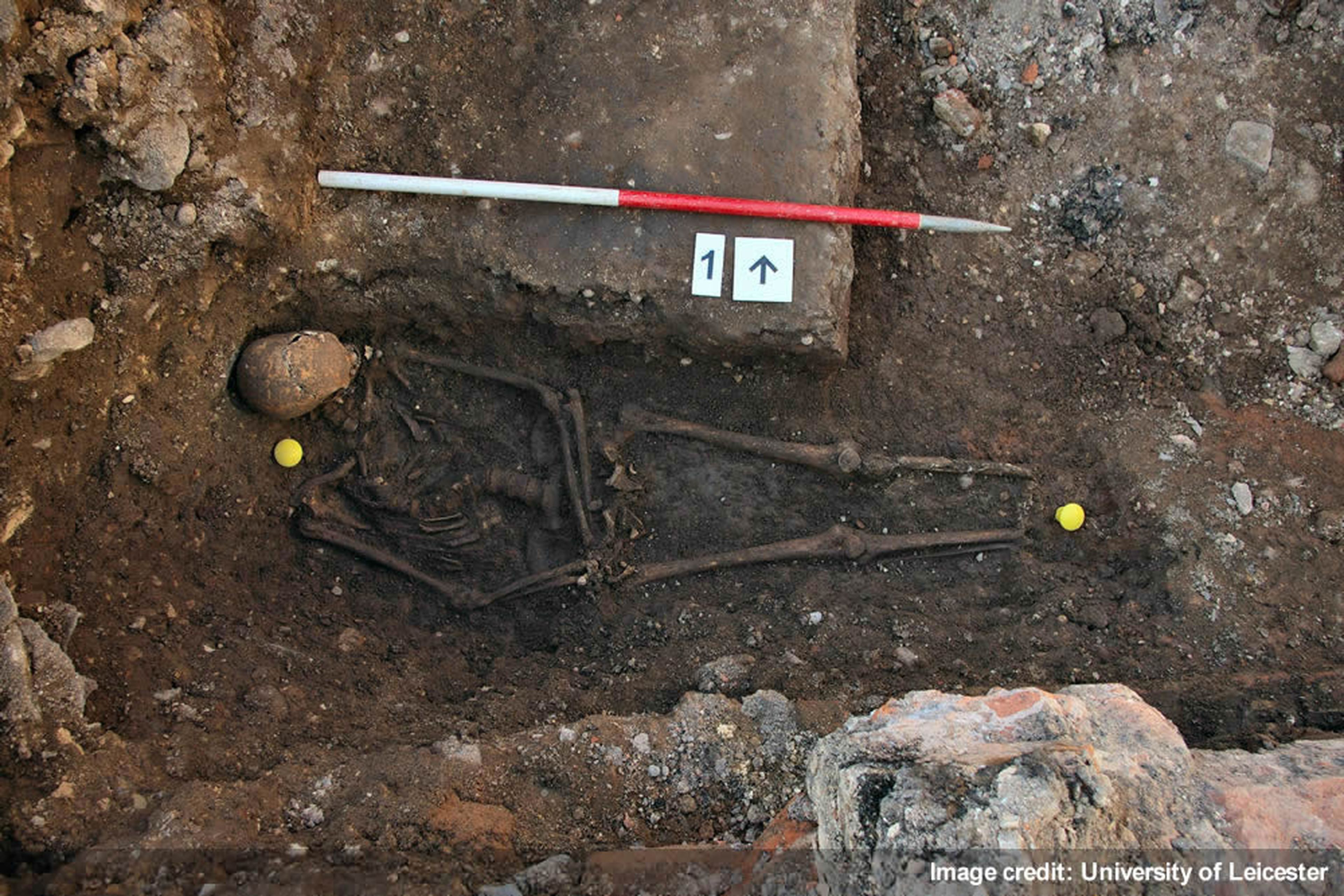 King Richard III Skeleton