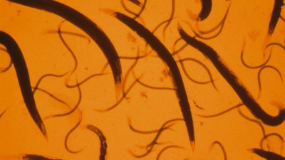 Mikroskopische Ansicht von Nematoden auf hellem Hintergrund