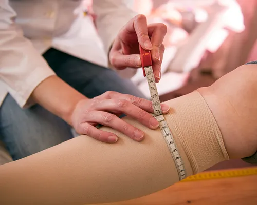 Kompressionsstrümpfe Knie oder Oberschenkel, Wade von Frau wird abgemessen, Hilfe bei Krampfadern, Ödeme