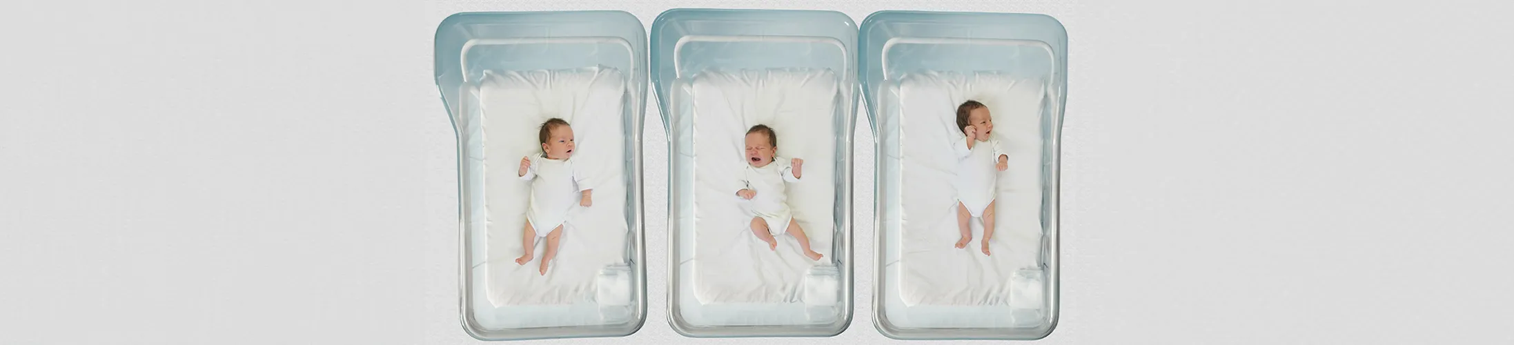 Spina Bifida, drei Säuglinge in Babybetten im Krankenhaus, offener Rücken, angeborene Behinderung