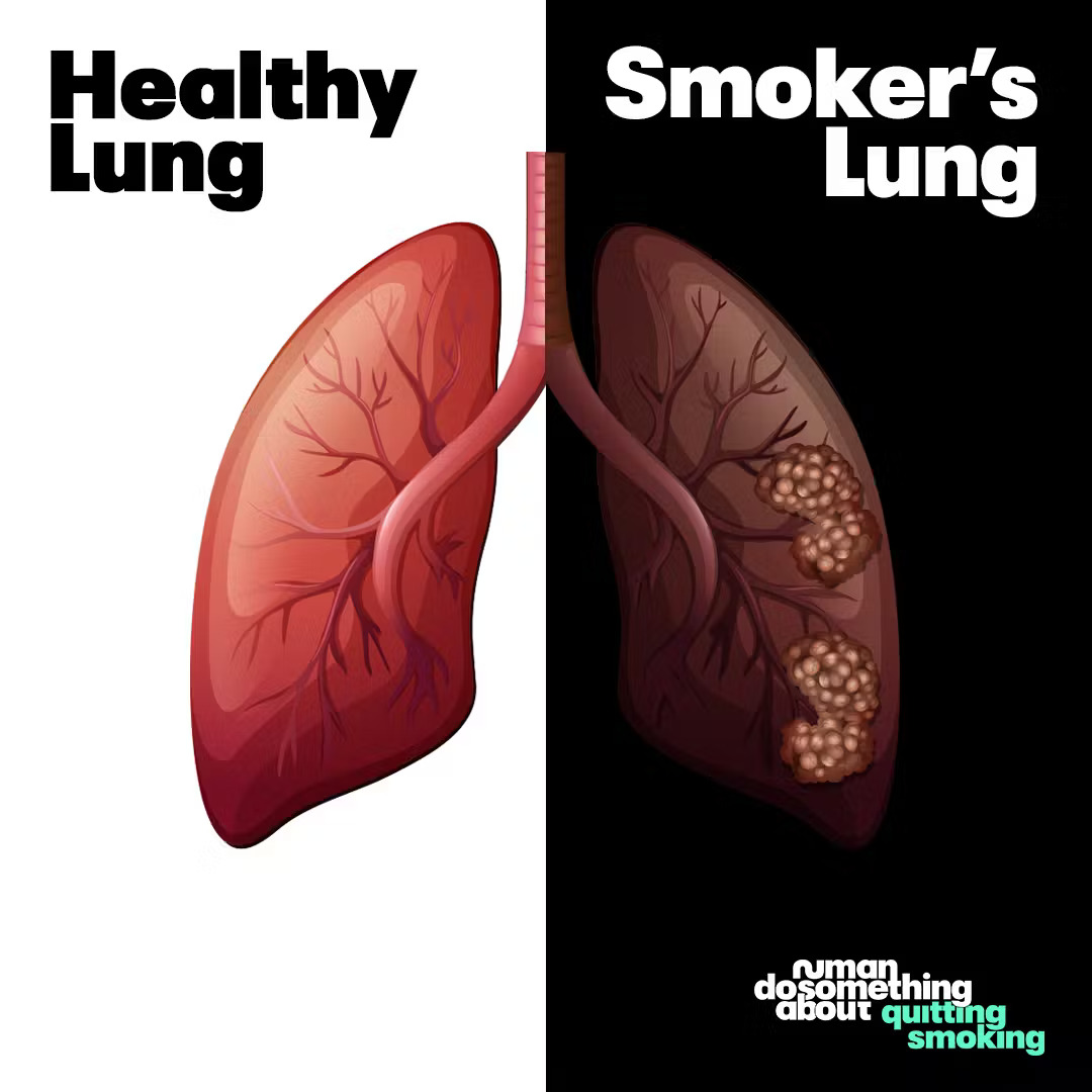 Before And After Cigarettes Before And After Cigarettes