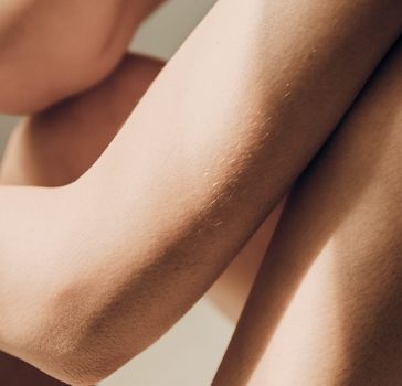 image of arms and legs