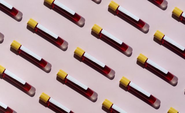 two-blood-tests-diagnose-low-testosterone