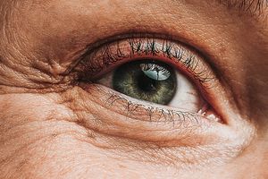eye