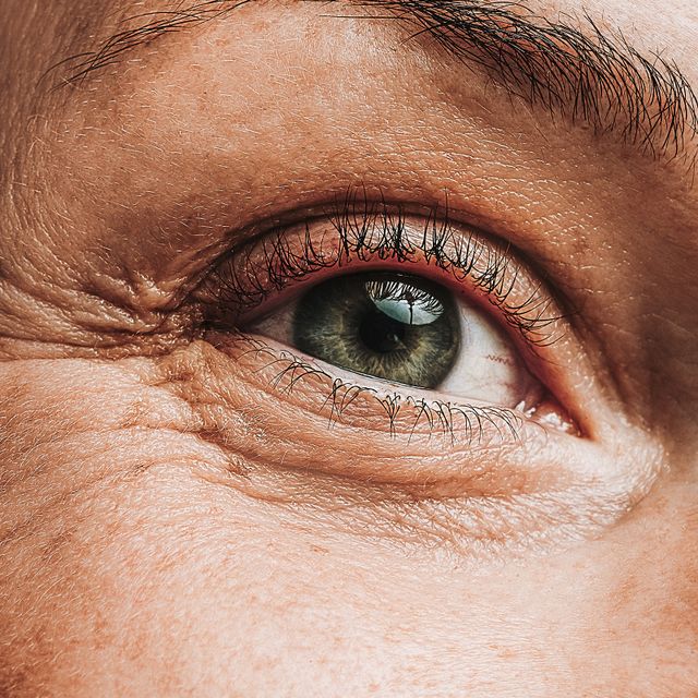 eye