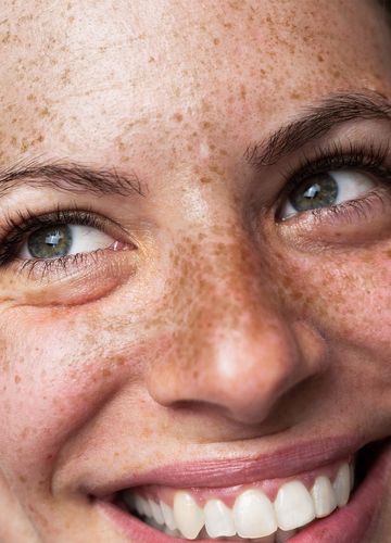 Freckly woman smiling