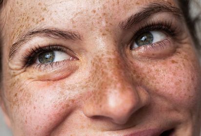 Freckly woman smiling