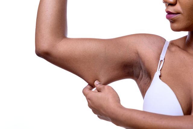 woman loose skin
