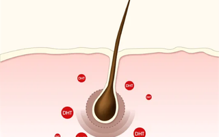 How finasteride helps