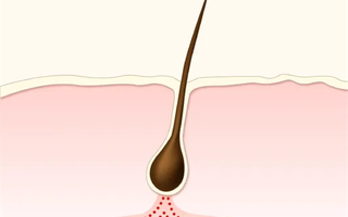 How minoxidil helps