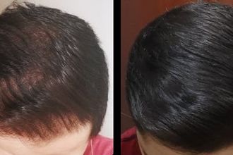 arturo-hair