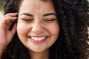 happy woman with freckles