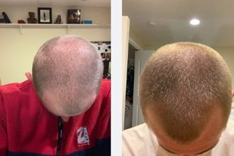grant-hair