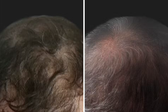 chris-hair